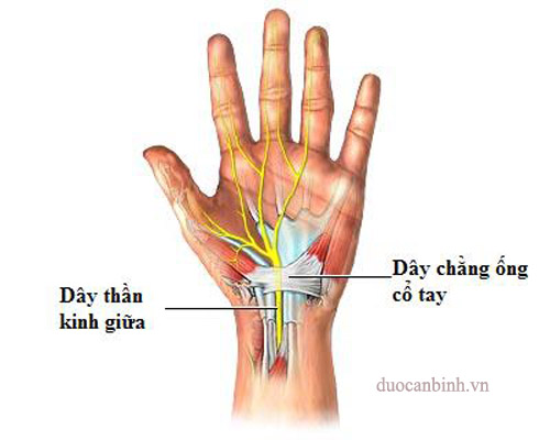 Hội chứng ống cổ tay